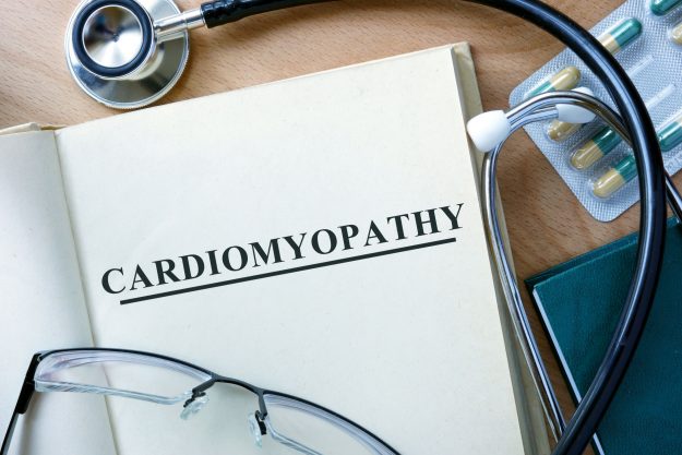 La cardiomyopathie hypertrophique