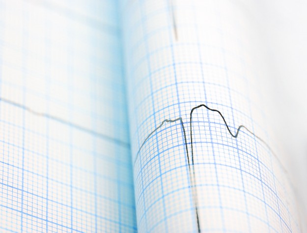 Bradycardies physiologiques