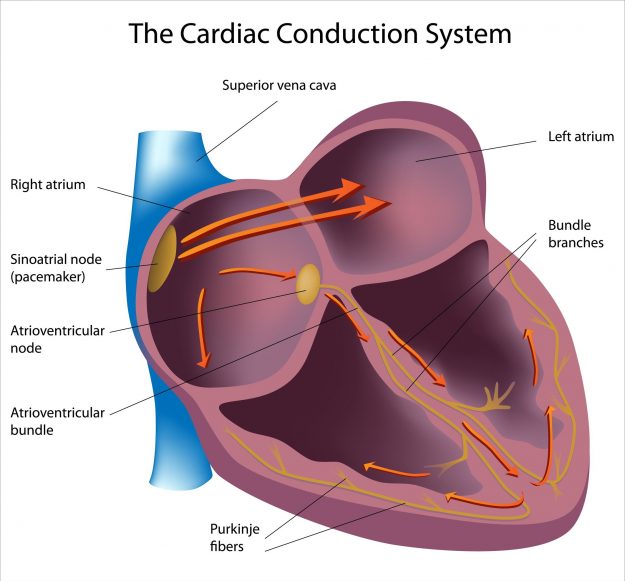 Differents troubles de la conduction