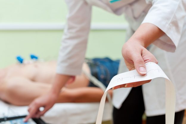 L'électrocardiogramme