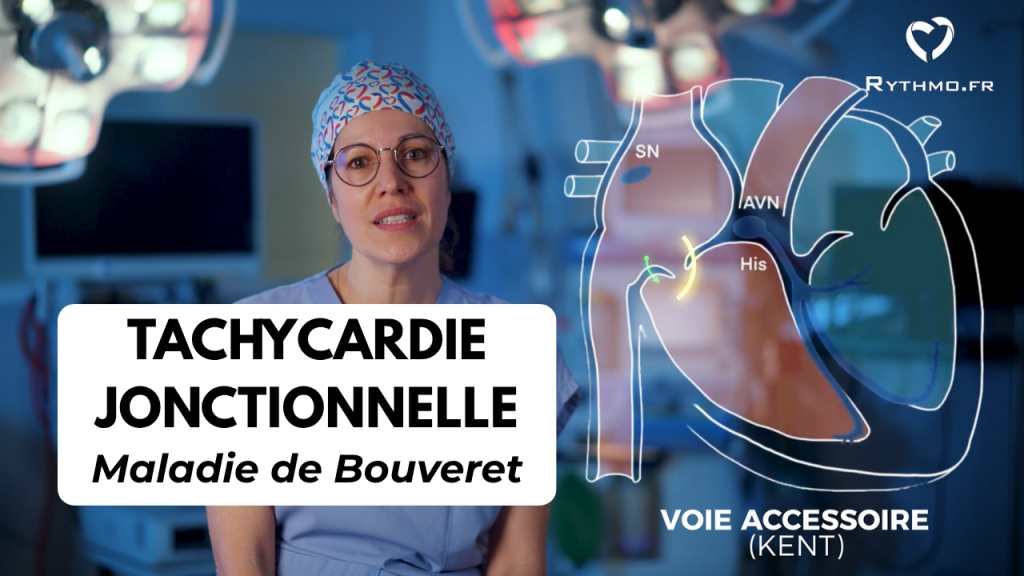 Tachycardie jonctionnelle maladie de bouveret ICPS