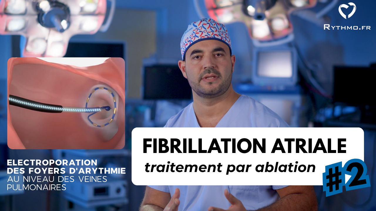 Fibrillation atriale traitement par ablation